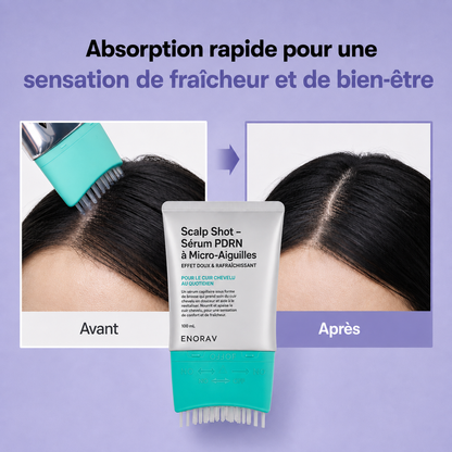 Scalp Shot – Sérum PDRN à Micro-Aiguilles