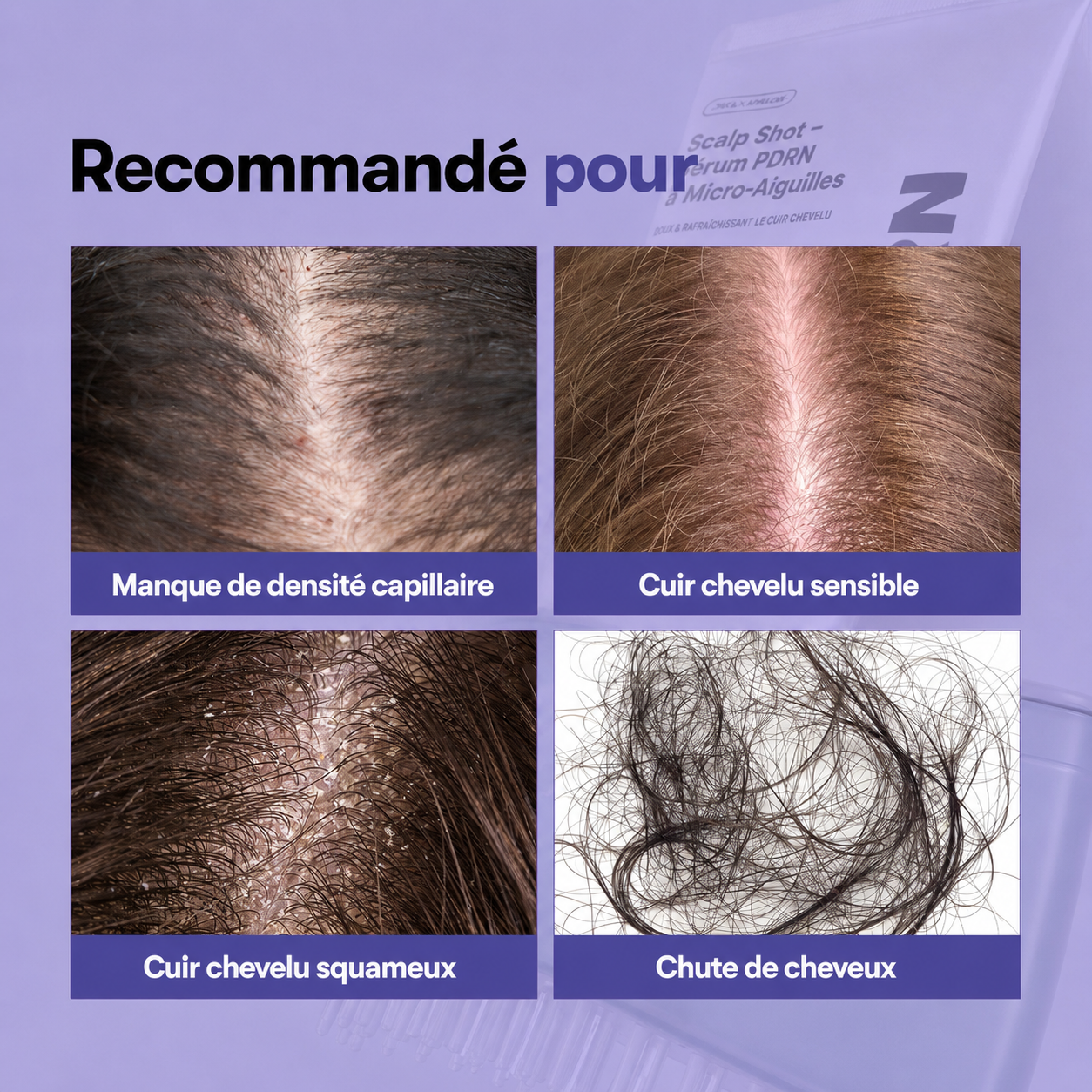 Scalp Shot – Sérum PDRN à Micro-Aiguilles