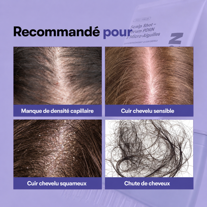 Scalp Shot – Sérum PDRN à Micro-Aiguilles