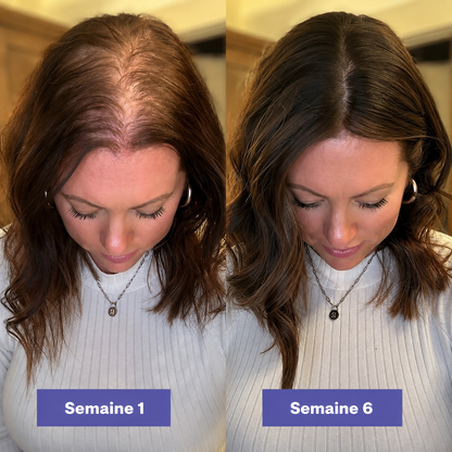 Scalp Shot – Sérum PDRN à Micro-Aiguilles
