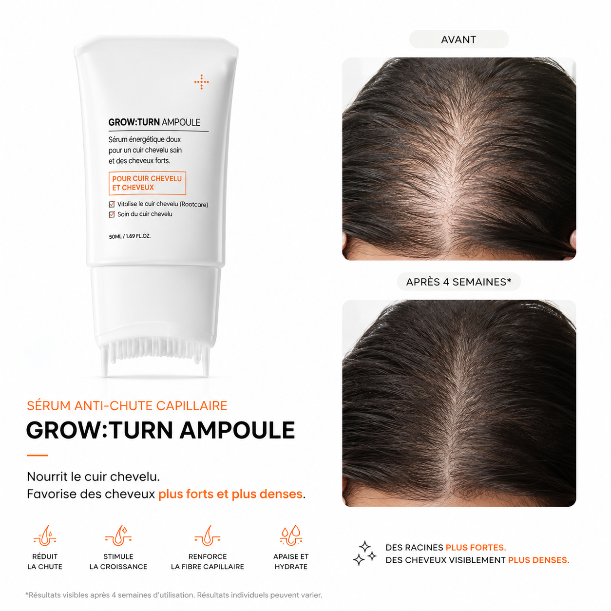 Growturn – Sérum Anti-Chute & Repousse
